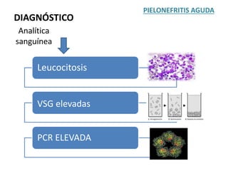 Analítica
sanguínea
PIELONEFRITIS AGUDA
DIAGNÓSTICO
Leucocitosis
VSG elevadas
PCR ELEVADA
 