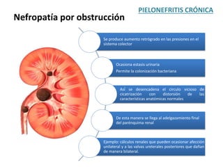 PIELONEFRITIS CRÓNICA
Nefropatía por obstrucción
Se produce aumento retrógrado en las presiones en el
sistema colector
Ocasiona estasis urinaria
Permite la colonización bacteriana
Así́ se desencadena el circulo vicioso de
cicatrización con distorsión de las
características anatómicas normales
De esta manera se llega al adelgazamiento final
del parénquima renal
Ejemplo: cálculos renales que pueden ocasionar afección
unilateral y a las valvas ureterales posteriores que dañan
de manera bilateral.
 
