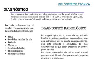 En ocasiones los pacientes son diagnosticados en la edad adulta como
resultado de una exploración clínica por HTA (38%), proteinuria (31%), IRC
(10%) o alteraciones crónicas del sedimento urinario o bacteriuria
PIELONEFRITIS CRÓNICA
DIAGNÓSTICO
Lo más relevante es el
cuadro clínico secundario a
la lesión tubulointersticial:
• HTA
• Perdidas renales de Na
• Poliuria
• Nicturia
• Acidosis tubular
• Hipercloremia
• Hiperpotasemia
DIAGNÓSTICO RADIOLÓGICO
La imagen típica es la presencia de lesiones
focales o cicatrices corticales acompañadas con
una retracción de la papila correspondiente,
que está dilatada y amputada. Lo más
característico es que estén presentes en ambos
polos renales.
Las áreas intermedias de tejido renal normal
pueden sufrir hipertrofiaa presentando aspecto
de masa o seudotumor.
 
