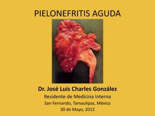 PIELONEFRITIS AGUDA




Dr. José Luis Charles González
  Residente de Medicina Interna
  San Fernando, Tamaulipas, México
          30 de Mayo, 2012
 