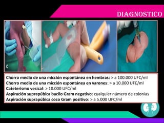 DIAGNOSTICO
Chorro medio de una micción espontánea en hembras: > a 100.000 UFC/ml
Chorro medio de una micción espontánea e...