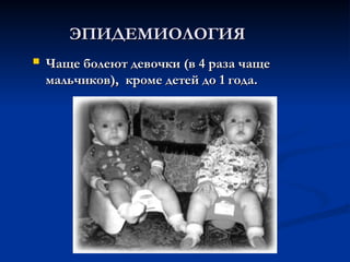 ЭПИДЕМИОЛОГИЯ
ЭПИДЕМИОЛОГИЯ
 Чаще болеют девочки (в 4 раза чаще
Чаще болеют девочки (в 4 раза чаще
мальчиков), кроме детей до 1 года.
мальчиков), кроме детей до 1 года.
 