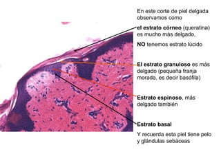 En este corte de piel delgada
observamos como
el estrato córneo (queratina)
es mucho más delgado,
NO tenemos estrato lúcido
El estrato granuloso es más
delgado (pequeña franja
morada, es decir basófila)
Estrato espinoso, más
delgado también
Estrato basal
Y recuerda esta piel tiene pelo
y glándulas sebáceas
 