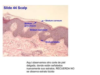 Aquí observamos otro corte de piel
delgada, donde están señalados
nuevamente sus estratos, RECUERDA NO
se observa estrato lúcido
 