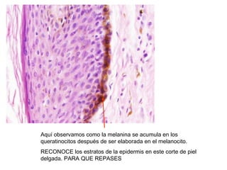 Aquí observamos como la melanina se acumula en los
queratinocitos después de ser elaborada en el melanocito.
RECONOCE los estratos de la epidermis en este corte de piel
delgada. PARA QUE REPASES
 