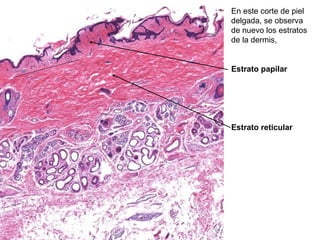 En este corte de piel
delgada, se observa
de nuevo los estratos
de la dermis,
Estrato papilar
Estrato reticular
 