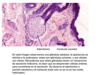 En esta imagen observamos una glándula sebácea, la apariencia es
distinta a la sudorípara, estas son glándulas acinares, y sus células
son claras. Recordemos que estas glándulas tienen un mecanismo
de secreción holócrina, es decir que se desprenden células enteras
para convertirse en la secreción. Se observa el adenómero o
porción secretora y el conducto (este casi no se ve en los cortes
habituales)
Adenómero Conducto excretor
 