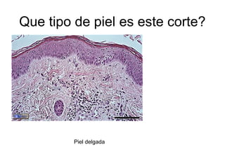 Que tipo de piel es este corte?
Piel delgada
 