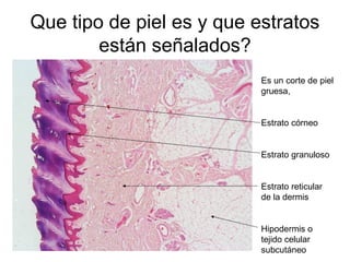 Que tipo de piel es y que estratos
están señalados?
Es un corte de piel
gruesa,
Estrato córneo
Estrato granuloso
Estrato reticular
de la dermis
Hipodermis o
tejido celular
subcutáneo
 