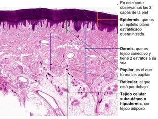 En este corte
observamos las 3
capas de la piel
Epidermis, que es
un epitelio plano
estratificado
queratinizado
Dermis, que es
tejido conectivo y
tiene 2 estratos a su
vez
Papilar, es el que
forma las papilas
Reticular, el que
está por debajo
Tejido celular
subcutáneo o
hipodermis, con
tejido adiposo
 