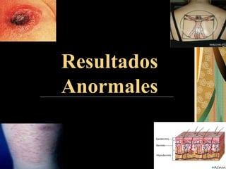 Resultados Anormales 