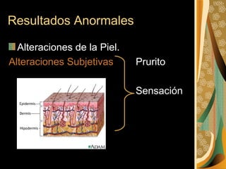 Resultados Anormales Alteraciones de la Piel. Alteraciones Subjetivas   Prurito   Sensación  de    Calor y Frío   Quemaduras 