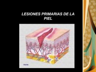 LESIONES PRIMARIAS DE LA PIEL 