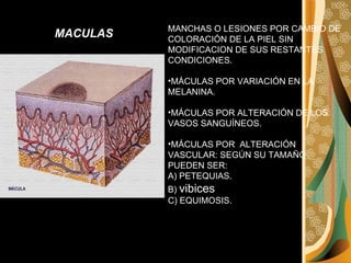 MANCHAS O LESIONES POR CAMBIO DE COLORACIÓN DE LA PIEL SIN MODIFICACION DE SUS RESTANTES CONDICIONES. MÁCULAS POR VARIACIÓN EN LA MELANINA. MÁCULAS POR ALTERACIÓN DE LOS VASOS SANGUÍNEOS. MÁCULAS POR  ALTERACIÓN VASCULAR: SEGÚN SU TAMAÑO PUEDEN SER: A) PETEQUIAS. B)  vibices C) EQUIMOSIS. MACULAS   