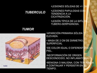 LESIONES SÓLIDAS DE >1 CM. LESIONES PAPULOSAS CON TENDENCIA A LA CICATRIZACIÓN. LESIÓN TÍPICA DE LA SIFÍLIDE TUBERO-SERPIGINOSA. TUBERCULO TUMOR APARICIÓN PRIMARIA SÓLIDA Y ELEVADA. MASA DE 2 CM DE DIÁMETRO, SUPERFICIAL  DE COLOR IGUAL O DIFERENTE DE LA PIEL.  NEOFORMACIÓN DE ORIGEN DESCONOCIDO, NO INFLAMATORIA. BENIGNA O MALIGNA, CON TENDENCIA A CONTINUAR Y PERSISTIR EN EL TIEMPO. 