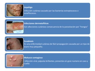Impétigo 
Infección cutánea causado por las bacterias estreptococos o 
estafilococos. 
Infecciones dermatofíticas 
Son afecciones cutáneas consecuencia de la parasitación por "hongos" 
Escabiosis 
Es una enfermedad cutánea de fácil propagación causada por un tipo de 
ácaro muy pequeño. 
Molusco contagioso 
Infección viral, pápulas brillantes, presentes en gran numero en cara y 
cuello 
 