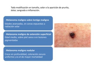 Toda modificación en tamaño, color o la aparición de prurito, 
dolor, sangrado o inflamación. 
- Melanoma maligno sobre lentigo maligno 
Edades avanzadas, en zonas expuestas a 
radiación solar 
- Melanoma maligno de extensión superficial 
Edad media, sobre piel sana o en lesiones 
pigmentadas 
- Melanoma maligno nodular 
Crece en profundidad, coloración oscura 
uniforme y es el de mayor mortalidad 
 