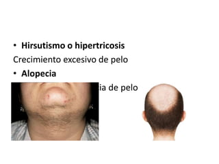 • Hirsutismo o hipertricosis 
Crecimiento excesivo de pelo 
• Alopecia 
Disminución o ausencia de pelo 
 