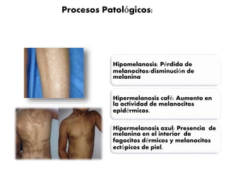 Procesos Patológicos: 
Hipomelanosis: Pérdida de 
melanocitos/disminución de 
melanina 
Hipermelanosis café: Aumento en 
la actividad de melanocitos 
epidérmicos. 
Hipermelanosis azul: Presencia de 
melanina en el interior de 
fagocitos dérmicos y melanocitos 
ectópicos de piel. 
 