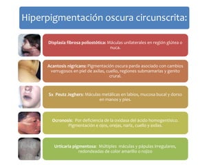 Hiperpigmentación oscura circunscrita: 
Displasia fibrosa poliostótica: Máculas unilaterales en región glútea o 
nuca. 
Acantosis nigricans: Pigmentación oscura parda asociado con cambios 
verrugosos en piel de axilas, cuello, regiones submamarias y genito 
crural. 
Sx Peutz Jeghers: Máculas metálicas en labios, mucosa bucal y dorso 
en manos y pies. 
Ocronosis: Por deficiencia de la oxidasa del ácido homogentisico. 
Pigmentación e ojos, orejas, nariz, cuello y axilas. 
Urticaria pigmentosa: Múltiples máculas y pápulas irregulares, 
redondeadas de color amarillo o rojizo 
 