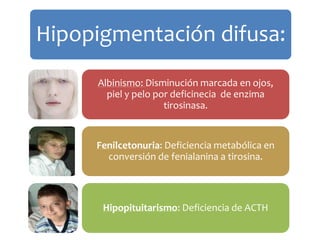 Hipopigmentación difusa: 
Albinismo: Disminución marcada en ojos, 
piel y pelo por deficinecia de enzima 
tirosinasa. 
Fenilcetonuria: Deficiencia metabólica en 
conversión de fenialanina a tirosina. 
Hipopituitarismo: Deficiencia de ACTH 
 
