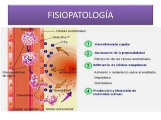 FISIOPATOLOGÍA 
 