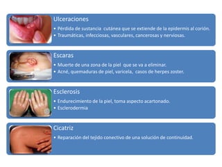 Ulceraciones 
• Pérdida de sustancia cutánea que se extiende de la epidermis al corión. 
• Traumáticas, infecciosas, vasculares, cancerosas y nerviosas. 
Escaras 
• Muerte de una zona de la piel que se va a eliminar. 
• Acné, quemaduras de piel, varicela, casos de herpes zoster. 
Esclerosis 
• Endurecimiento de la piel, toma aspecto acartonado. 
• Esclerodermia 
Cicatriz 
• Reparación del tejido conectivo de una solución de continuidad. 
 