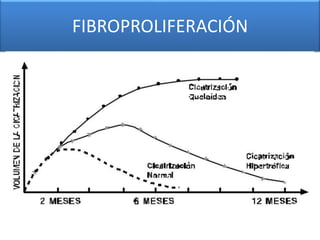 FIBROPROLIFERACIÓN 
 