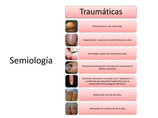 Semiología 
Traumáticas 
Onicocriptosis: uña enterrada. 
Hapaloniquia: ruptura de la parte distal de la uña. 
Onicofagia: habito de comerse las uñas. 
Hematoma subungueal: formado por traumatismos 
súbitos e intensos. 
Perionixis: alteración conocida como “padrastros” y 
constituida por pequeños fragmentos que se 
desprenden de los pliegues dérmicos. 
Defecto de corte de las uñas. 
Alteracioes en la dirección de la uña. 
 
