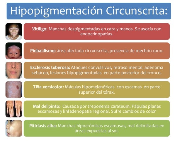El aceite de ricino como el medio de las manchas de pigmento