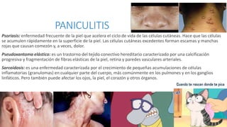 PANICULITIS
Psoriasis: enfermedad frecuente de la piel que acelera el ciclo de vida de las células cutáneas. Hace que las células
se acumulen rápidamente en la superficie de la piel. Las células cutáneas excedentes forman escamas y manchas
rojas que causan comezón y, a veces, dolor.
Pseudoxantoma elástico: es un trastorno del tejido conectivo hereditario caracterizado por una calcificación
progresiva y fragmentación de fibras elásticas de la piel, retina y paredes vasculares arteriales.
Sarcoidosis: es una enfermedad caracterizada por el crecimiento de pequeñas acumulaciones de células
inflamatorias (granulomas) en cualquier parte del cuerpo, más comúnmente en los pulmones y en los ganglios
linfáticos. Pero también puede afectar los ojos, la piel, el corazón y otros órganos.
 