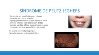 SÍNDROME DE PEUTZ-JEGHERS
Dentro de sus manifestaciones clínicas
podemos encontrar máculas
hiperpigmentadas que suelen aparecer en la
primera infancia y se localizan en dedos,
palmas, plantas, labios, mucosa bucal, lengua
y regiones perioral, periorbital y perinasal.
Se asocia con múltiples pólipos
hamartomatosos gastrointestinales.
 