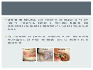  Escaras de decúbito. Esta condición patológica se ve con
relativa frecuencia, debido a múltiples factores que
condicionan una presión prolongada en sitios de prominencias
óseas.
 Es frecuente en pacientes postrados o con alteraciones
neurológicas. La mejor estrategia para su manejo es la
prevención.

 