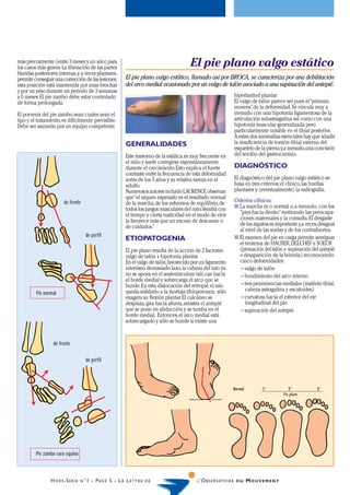 más precozmente (entre 3 meses y un año) para
los casos más graves. La liberación de las partes
                                                                                              El pie plano valgo estático
blandas posteriores, internas, y a veces plantares,
permite conseguir una corrección de las lesiones;              El pie plano valgo estático, llamado así por BROCA, se caracteriza por una debilitación
esta posición está mantenida por unas brochas                  del arco medial ocasionado por un valgo de talón asociado a una supinación del antepié.
y por un yeso durante un periodo de 3 semanas
a 6 meses. El pie zambo debe estar controlado                                                                        hiperlaxitud plantar.
de forma prolongada.                                                                                                 El valgo de talón parece ser pues el “primum
                                                                                                                     movens” de la deformidad. Se vincula muy a
El porvenir del pie zambo, sean cuales sean el                                                                       menudo con una hipotonía ligamentosa de la
tipo y el tratamiento, es difícilmente previsible.                                                                   articulación subastragalina así como con una
Debe ser asumido por un equipo competente.                                                                           hipotonía muscular generalizada pero
                                                                                                                     particularmente notable en el tibial posterior.
                                                                                                                     A estas dos anomalías esenciales hay que añadir
                                                               GENERALIDADES                                         la insuficiencia de torsión tibial externa del
                                                                                                                     esqueleto de la pierna y, a menudo, una concisión
                                                               Este trastorno de la estática es muy frecuente en     del tendón del gastrocnemio.
                                                               el niño y suele corregirse espontáneamente
                                                               durante el crecimiento. Esto explica el fuerte        DIAGNÓSTICO
                                                               contraste entre la frecuencia de esta deformidad
                                                               antes de los 5 años y su relativa rareza en el        El diagnóstico del pie plano valgo estático se
                                                               adulto.                                               basa en tres criterios: el clínico, las huellas
                                                               Numerosos autores incluido LAURENCE observan          plantares y (eventualmente) la radiografía.
                                                               que “el arqueo esperado es el resultado normal
                         de frente                             de la marcha, de los esfuerzos de equilibrio, de      Criterios clínicos:
                                                               todos los juegos musculares del niño.Vendrá con       s La marcha es o normal o, a menudo, con los
                                                               el tiempo y cierta rusticidad en el modo de vivir        “pies hacia dentro” motivando las preocupa-
                                                               la favorece más que un exceso de descanso o              ciones maternales y la consulta. El desgaste
                                                               de cuidados.”                                            de los zapatos es importante y, a veces, desigual
                                                                                                                        al nivel de las suelas y de los contrafuertes.
                                        de perfil                                                                    s El examen del pie en carga permite averiguar
                                                               ETIOPATOGENIA
                                                                                                                        el teorema de HAUSER, DELCHEF y SOEUR
                                                               El pie plano resulta de la acción de 2 factores:         (pronación del talón + supinación del antepié
                                                               valgo de talón + hipotonia plantar.                      = desaparición de la bóveda) reconociendo
                                                               En el valgo de talón, favorecido por un ligamento        cinco deformidades:
                                                               interóseo demasiado laxo, la cabeza del talo ya          – valgo de talón
                                                               no se apoya en el sustentaculum tali; cae hacia          – hundimiento del arco interno
                                                               el borde medial y sobrecarga el arco que se
                                                               hunde. En esta dislocación del retropié, el talo         – tres prominencias mediales (maléolo tibial,
                                                               queda solidario a la mortaja tibioperonea; sólo             cabeza astragalina y escafoides)
         Pie normal
                                                               exagera su flexión plantar. El calcáneo se               – curvatura hacia el exterior del eje
                                                               desplaza, gira hacia afuera, arrastra el antepié            longitudinal del pie.
                                                               que se pone en abducción y se tumba en el                – supinación del antepié.
                                                               borde medial. Entonces, el arco medial está
                                                               sobrecargado y sólo se hunde si existe una


                  de frente

                                        de perfil




                                                                                                                     Normal        1°            2°            3°
                                                                                                                                              Pie plano




         Pie zambo varo equino



                 H O R S -S É R I E   N °1   - P AG E 5 - L A L E T T R E   DE                   L ’O B S E RVATO I R E D U   MOUVEMENT
 