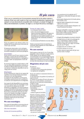 El pie cavo                             con prominencia de la estiloide del 5º
                                                                                                                         metatarsiano y oblicuidad del apoyo del talón
                                                                                                                         en varo.
El pie cavo se caracteriza por el acercamiento anormal de los dos pilares anterior y                                   – primer grado: disminución de la banda externa
posterior. El pie cavo más común es el pie cavo anterior metatarsiano (equinismo del                                     de la huella (>1/3).
antepié) con una desnivelación mesurable entre el retropié y el antepié. El ángulo de                                  – segundo grado: desaparición de la banda
Meary talo-metatarsiano es positivo. Su origen es, con mayor frecuencia, neurológico.                                    externa en el medio.
                                                                                                                       – tercer grado: la banda externa desaparece así
                                                                                                                         como la huella de los dedos.
                                                              Lesiones de origen central
                                                              – encefalopatía infantil (Little)                        El chequeo radiográfico comporta esencialmente
                                                              – sobre todo heredodegeneraciones                        los clichés en carga y en descarga de perfil
                                                                espinocerebelosas (Mollaret). Este grupo de            interno. Estos clichés permiten valorar la
                                                                afecciones se caracteriza por un aspecto               deformidad y su reductibilidad;
                                                                hereditario, por una atrofia medular y por un
                                                                ataque de las vías cerebelosas, sensitivas y           – el ángulo tibio-astragalino es normal o reducido.
                                                                piramidales.                                           – el eje del talo ya no está en la prolongación
                                                              – la enfermedad de Freidreich es la más clásica.           del 1er meta-tarsiano (ángulo de Meary
                                                                                                                         positivo). Es el criterio esencial; permite
El pie cavo posterior o pie calcáneo unido a una                                                                         eliminar el falso pie cavo valgo con huellas
parálisis del tríceps sural es poco frecuente, así            Existen numerosas formas incompletas. La
                                                              amiotrofía distal progresiva de Charcot-Marie se           tipo pie cavo 3er grado.
como el pie cavo total.
                                                              acerca a este grupo.                                     – el ángulo del cavo es inferior a 120º.
El tratamiento relacionado con la etiología y                                                                          – el eje del calcáneo en un varo.
con el grado de tolerancia está dominado por                  Pie cavo esencial                                        – se debe valorar la repercusión del pie cavo
los medios ortopédicos y las técnicas quirúrgicas.                                                                       anterior sobre el antepié.
                                                              Suele aparecer entre los 10 y los 12 años. Este
Generalidades:                                                diagnóstico debe ser llevado con gran reserva.
El pie normal es cavo. El cavo (cavus) se vuelve              Puede tratarse de una alteración frustre
patológico cuando pasa de los límites de la                   monosintomática de una heredodegeneración
normalidad (criterios anatómico y radiográfico)               espinocerebelosa (entre 61’5% C. Faye y 90% P   .
y cuando existe una hiperpresión al nivel del                 Janklevicg). La tolerancia funcional es superior
antepié.                                                      en el pie cavo esencial que en el pie neurológico.
Es anormal el ángulo de cavidad inferior a 140º               Diagnóstico del pie cavo
con una oblicuidad metatarsiana evaluada por
el ángulo de Meary. Observamos que, en el pie                 Se funda en:
cavo parcial o totalmente reductible, el cavo en              – el examen clínico
carga puede ser normal.                                       – el estudio de los componentes plantares
                                                              – la exploración radiográfica
Etiopatogenia:
El pie se deforma por culpa de una ruptura del                El pie cavo anterior es raramente doloroso en
equilibrio de las fuerzas tendino-musculares                  el adolescente.
actuando en la cara dorso-plantar.                            Lo que preocupa a los padres es la marcha y el
La ruptura de esta equilibrio, con frecuencia                 aspecto del pie.
neurológico, puede provenir de la parálisis de                La marcha es evocadora. El inicio del paso se
un músculo o de la hipertonia de un antagonista.              hace con el talón anterior y, al menos al
                                                              principio de su evolución, la deformidad se
Las causas de este desequilibrio son numerosas.               corrige en carga.
Conviene oponer el pie cavo neurológico al pie                En el paciente en estación de
cavo esencial del adolescente. Se debe                        pie, la deformidad es
dictaminar un diagnóstico con mucha prudencia                 característica:
ya que la deformidad del pie puede ser la única               – varo de talón (línea de
manifestación de una enfermedad neurológica.                    Helbing)
Por lo tanto, es importante ante todo pie cavo
efectuar un chequeo neurológico completo                      – actitud en garra de los dedos.
(motor, sensitivo, reflejo, estudio del paso,                 Durante el examen, conviene
palpación de los troncos nerviosos, electro-                  apreciar la reductibilidad de la
miografía, dosificación de las encimas                        deformidad y la importancia
musculares, etc...).                                          de la desnivelación. Se debe                                      Normal           1°          2°     3°
                                                                                                                                                            grado
                                                              observar al nivel del apoyo
Pie cavo neurológico                                          anterior la existencia de
                                                              hiperqueratosis interna, interna
Las causas de desequilibrio neuro-muscular son                y externa o medio-plantar.
múltiples, pueden ser centrales o periféricas.                El estudio de las huellas
                                                              plantares confirma los datos
Afecciones musculares.                                        clínicos. Según el estado, varios                                          Línea de Helbing
                                                              aspectos son posibles:
Lesiones de la neurona periférica.
                                                              – pie precavo: huella normal

                H O R S -S É R I E   N °1   - P AG E 7 - L A L E T T R E   DE                     L ’O B S E RVATO I R E D U   MOUVEMENT
 