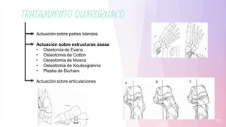 TRATAMIENTO QUIRÚRGICO
20
Actuación sobre partes blandas
Actuación sobre estructuras óseas
• Ostetomia de Evans
• Osteotomia de Cotton
• Osteotomia de Mosca
• Osteotomia de Koutsogiannis
• Plastia de Durham
Actuación sobre articulaciones
 