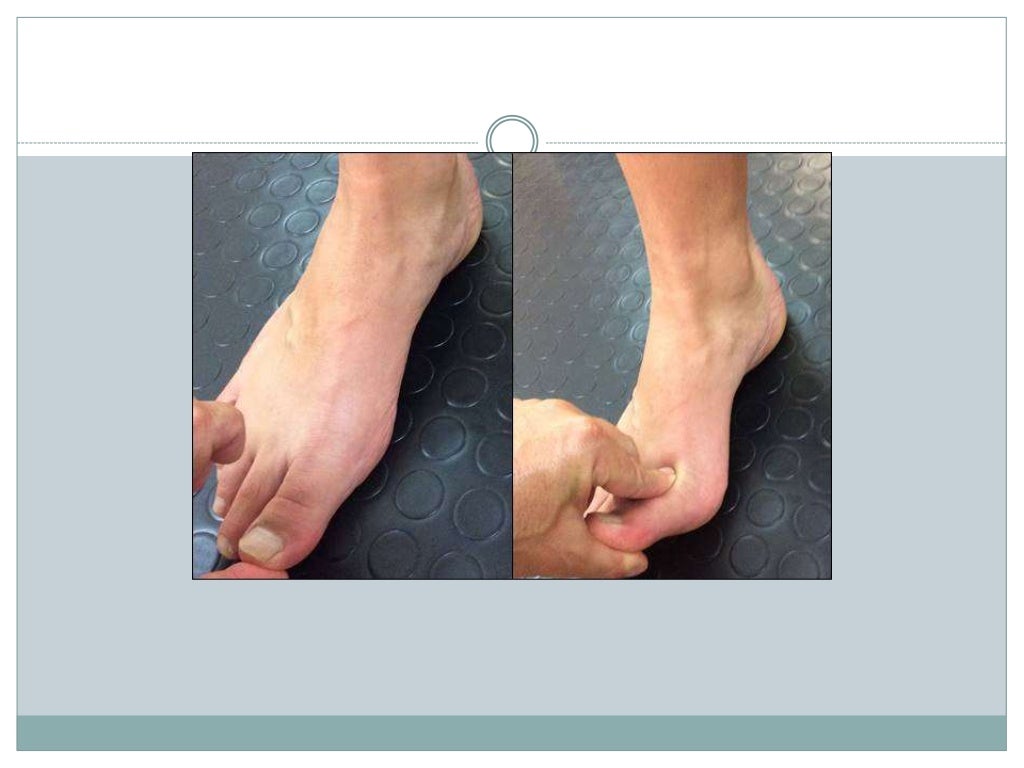 Pie plano y pie cavo