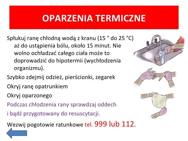 Pierwsza Pomoc Przy Oparzeniach W Punktach Pierwsza pomoc w pigułce