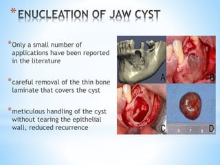 * 
*Only a small number of 
applications have been reported 
in the literature 
*careful removal of the thin bone 
laminate that covers the cyst 
*meticulous handling of the cyst 
without tearing the epithelial 
wall, reduced recurrence 
 
