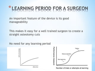 * 
An important feature of the device is its good 
manageability 
This makes it easy for a well trained surgeon to create a 
straight osteotomy cuts 
No need for any learning period 
 