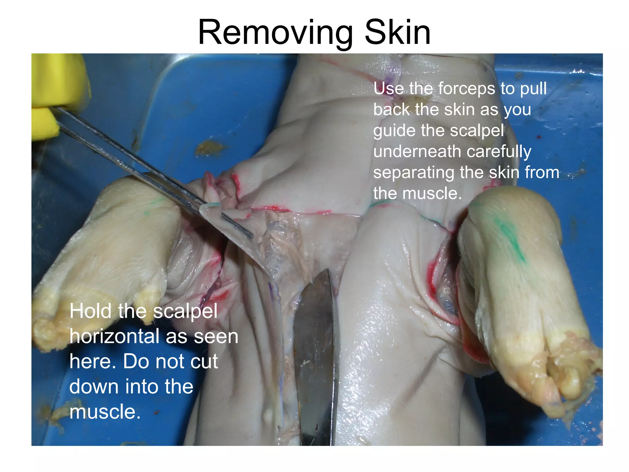 Removing Skin
Use the forceps to pull
back the skin as you
guide the scalpel
underneath carefully
separating the skin from
the muscle.
Hold the scalpel
horizontal as seen
here. Do not cut
down into the
muscle.
 