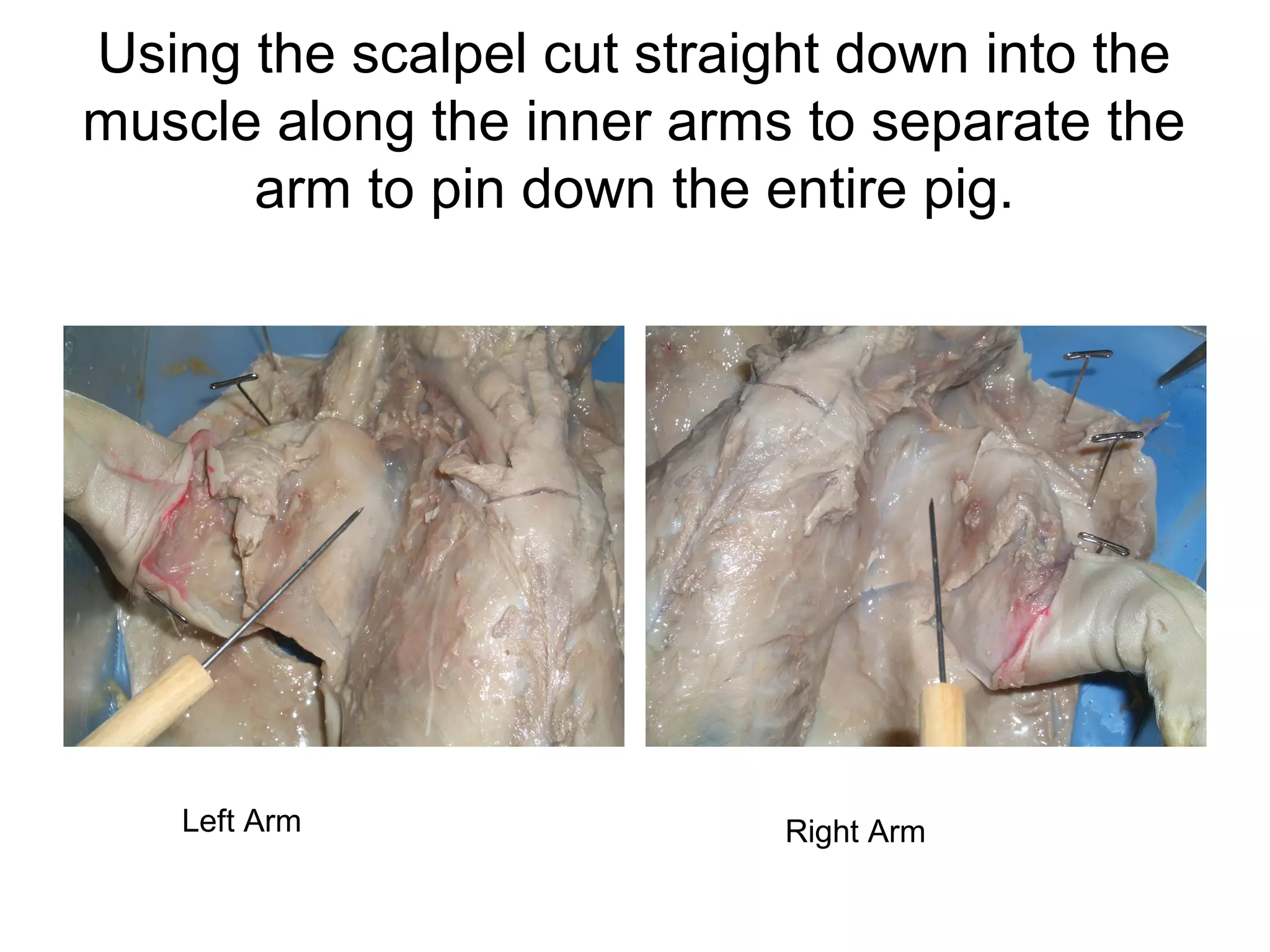 Using the scalpel cut straight down into the
muscle along the inner arms to separate the
arm to pin down the entire pig.
Left Arm Right Arm
 