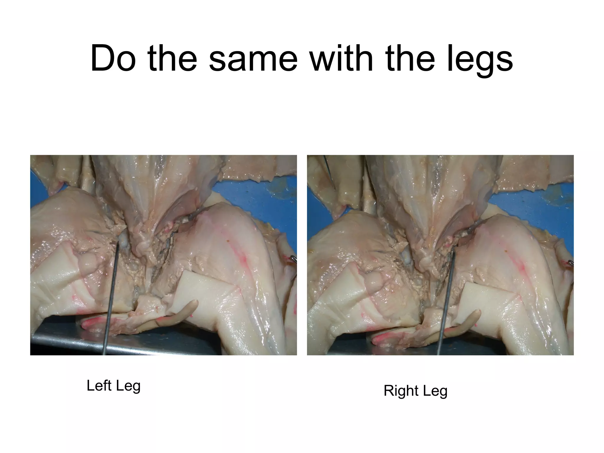 Do the same with the legs
Left Leg Right Leg
 