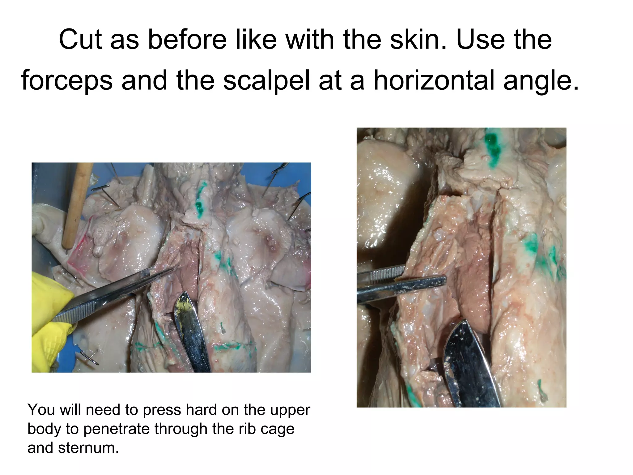 Cut as before like with the skin. Use the
forceps and the scalpel at a horizontal angle.
You will need to press hard on the upper
body to penetrate through the rib cage
and sternum.
 