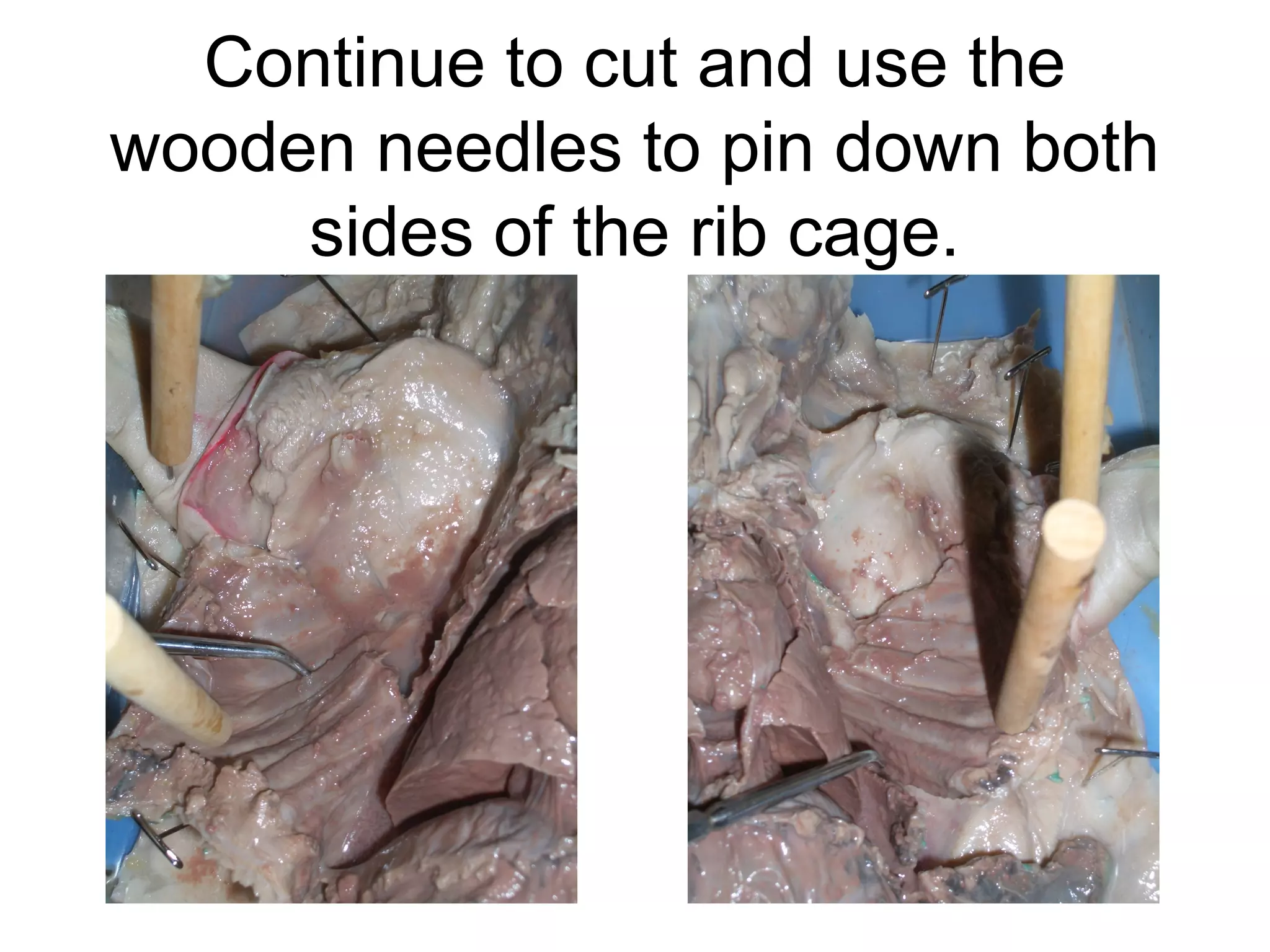 Continue to cut and use the
wooden needles to pin down both
sides of the rib cage.
 