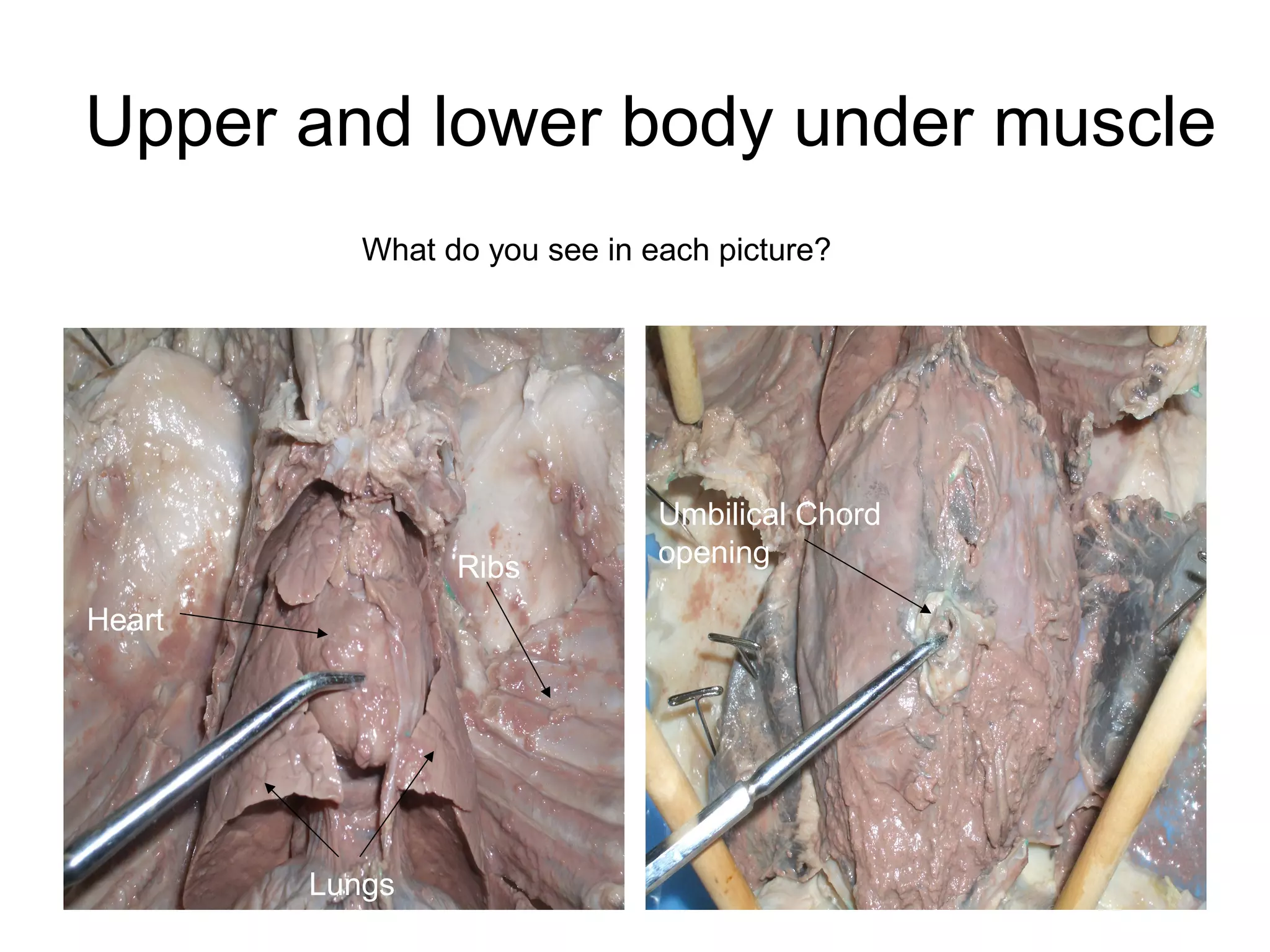 Upper and lower body under muscle
What do you see in each picture?
Heart
Lungs
Ribs
Umbilical Chord
opening
 