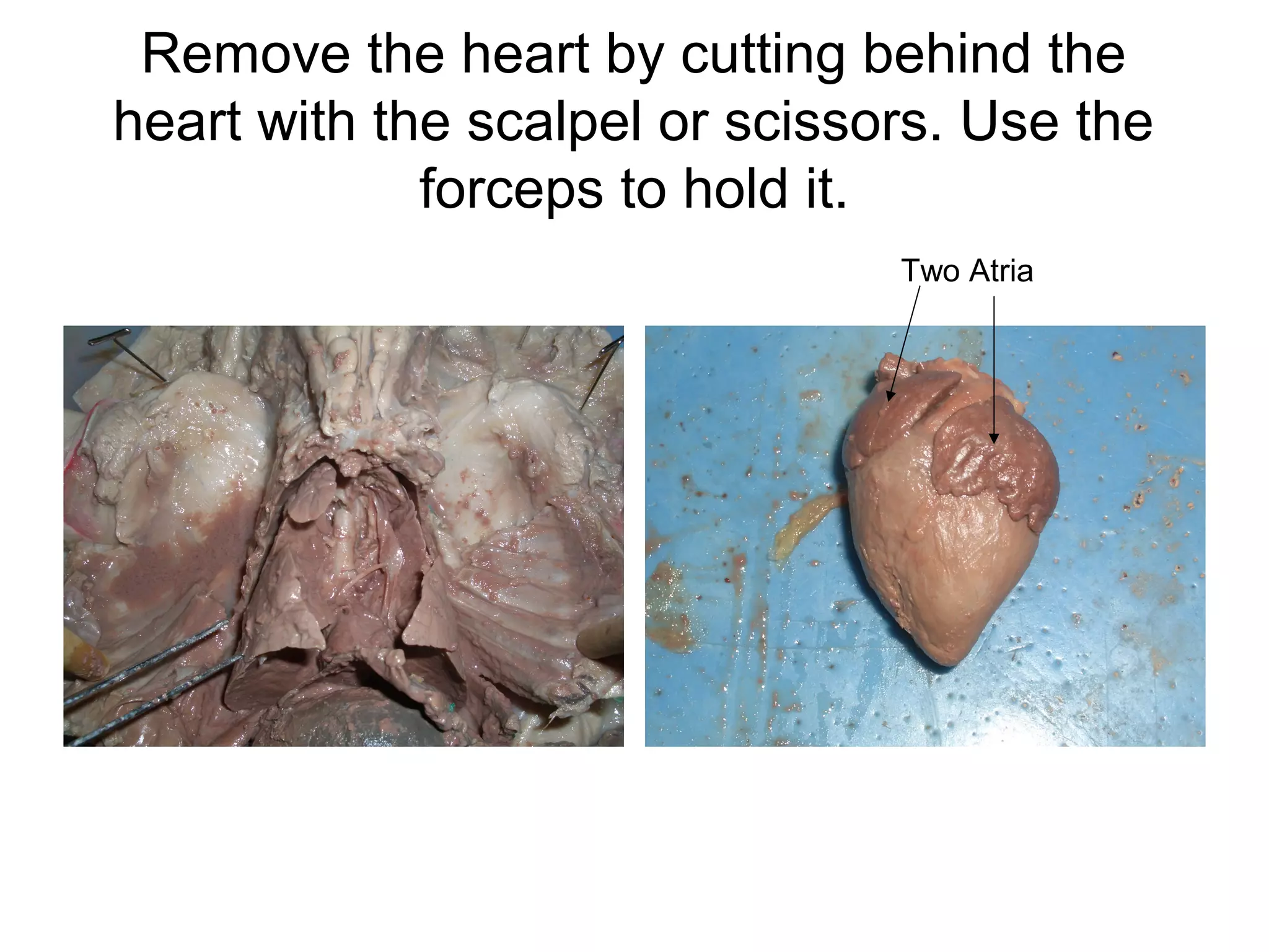 Remove the heart by cutting behind the
heart with the scalpel or scissors. Use the
forceps to hold it.
Two Atria
 