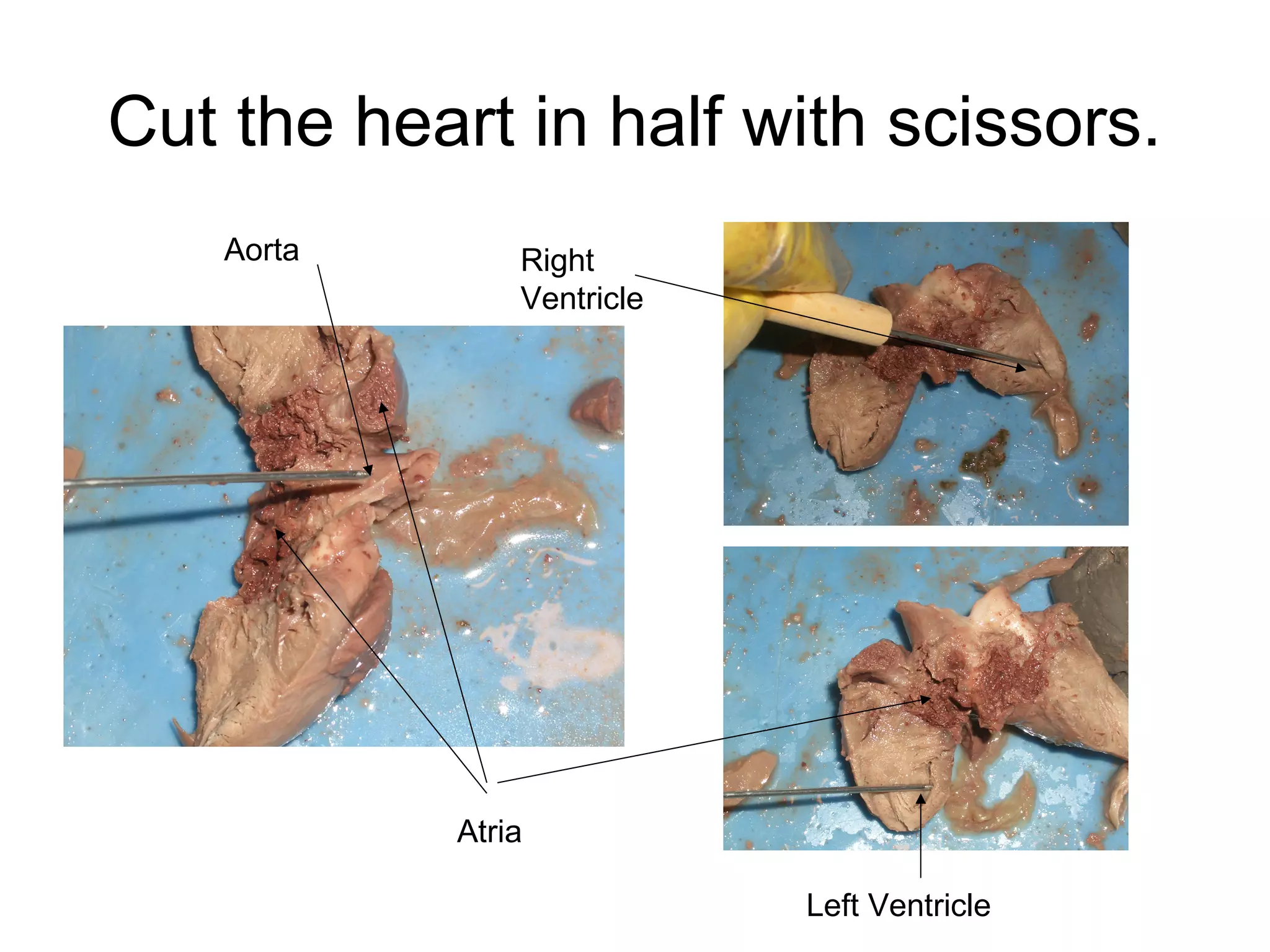 Cut the heart in half with scissors.
Aorta Right
Ventricle
Left Ventricle
Atria
 