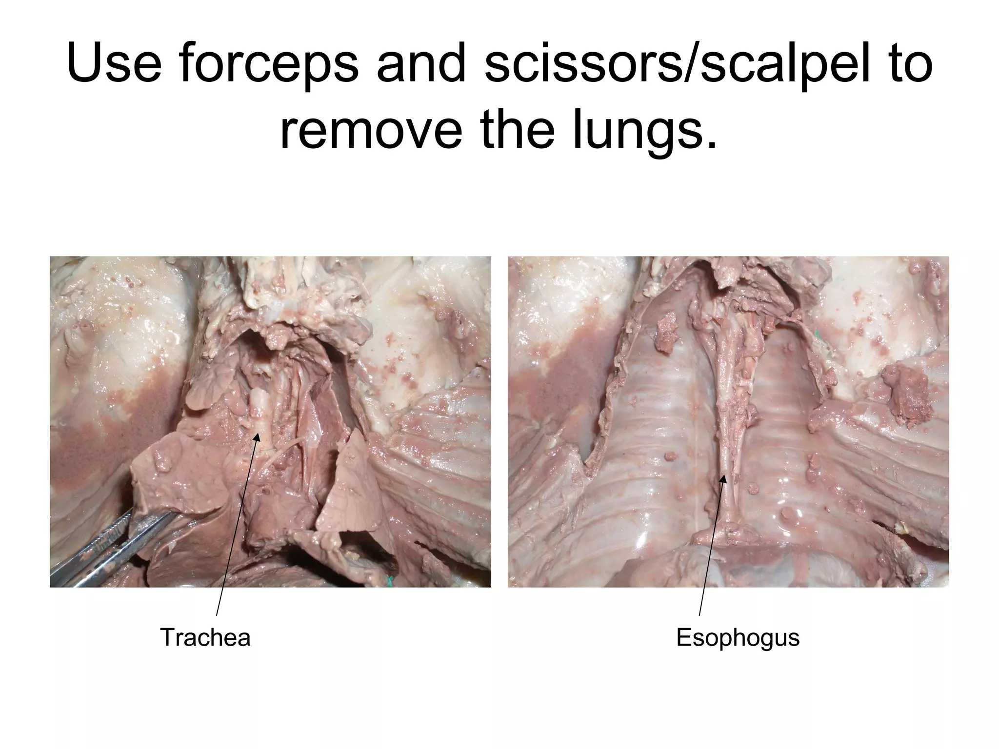Use forceps and scissors/scalpel to
remove the lungs.
Trachea Esophogus
 
