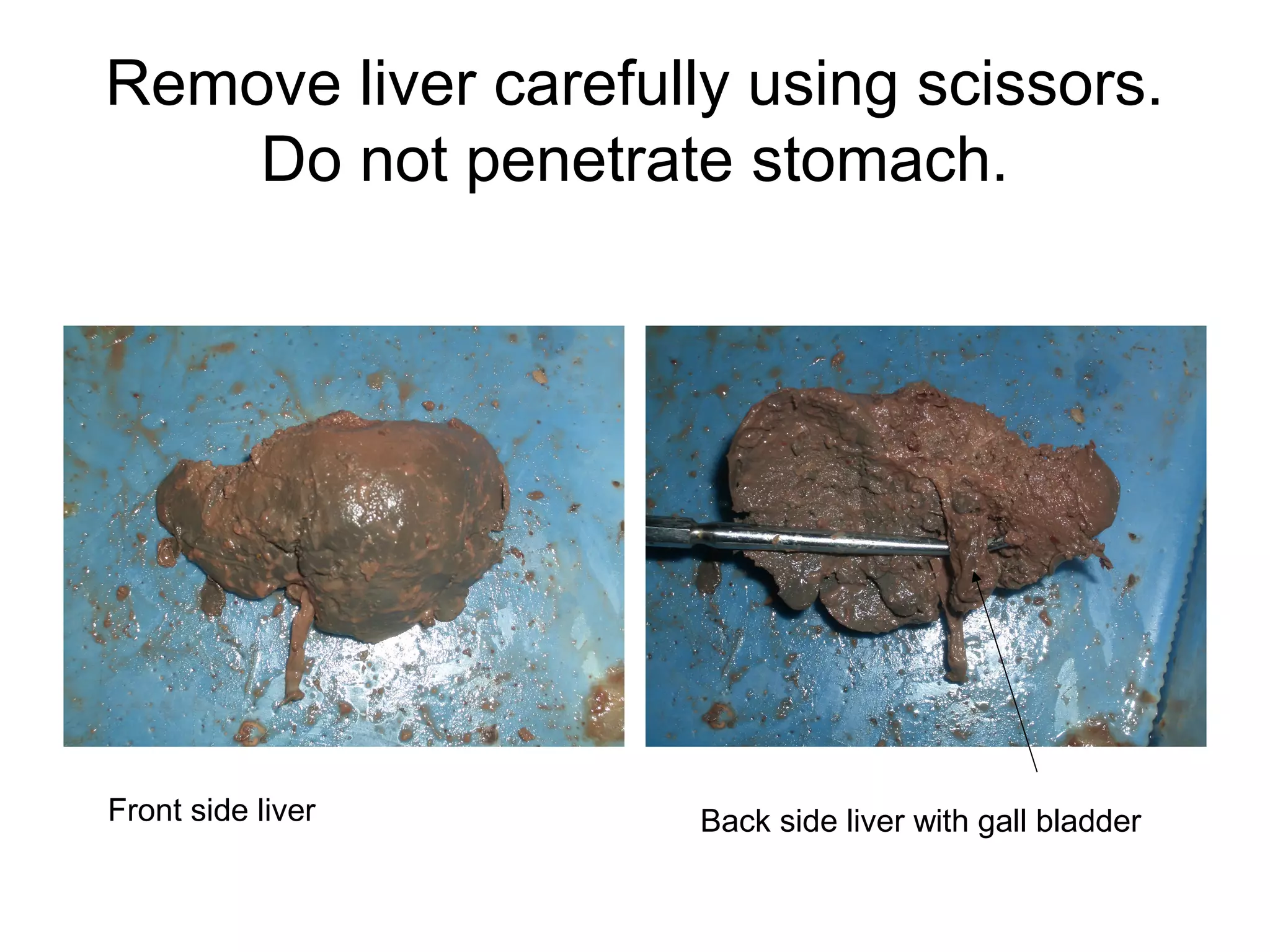 Remove liver carefully using scissors.
Do not penetrate stomach.
Front side liver Back side liver with gall bladder
 
